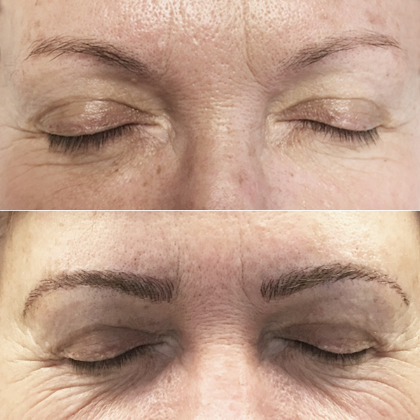 3D Eyebrow Embroidery Before and After