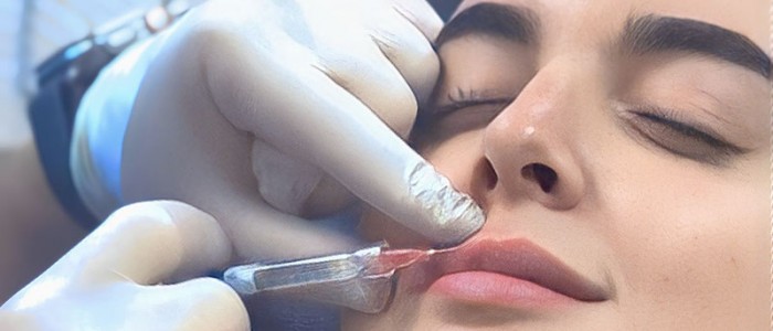 Lip-injections-with-Dr-Pisarenko