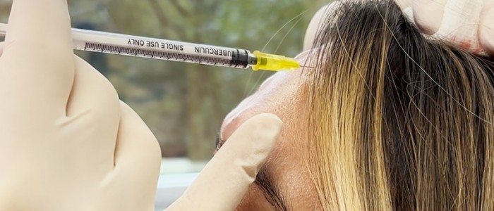 10-24-dysport-injectables1