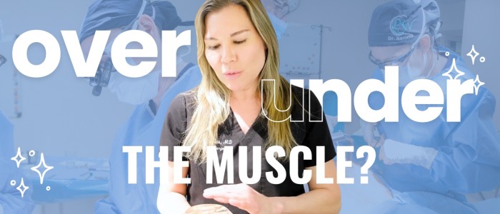 Breast implants over or under the muscle