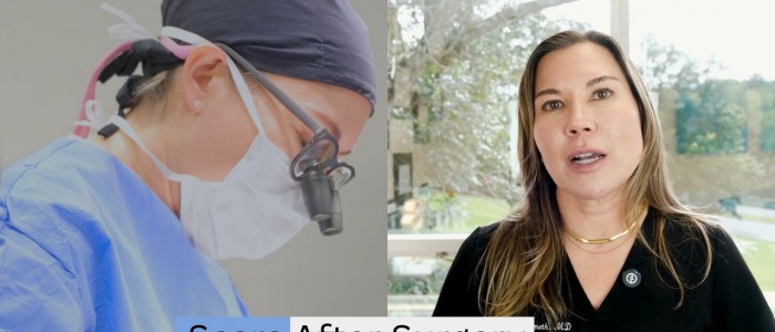 Upper Blepharoplasty While Awake! - 1