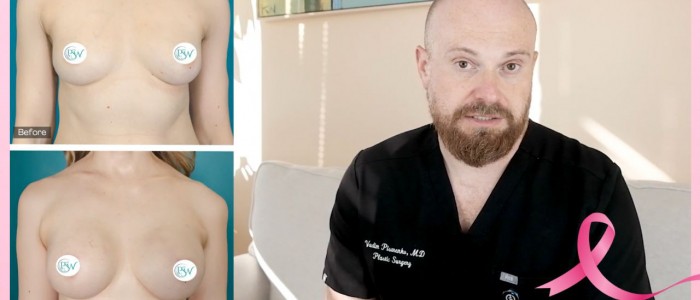 Upper Blepharoplasty While Awake! - 16