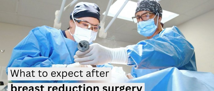 Upper Blepharoplasty While Awake! - 7