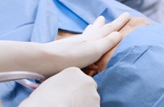 Upper Blepharoplasty While Awake! - 24