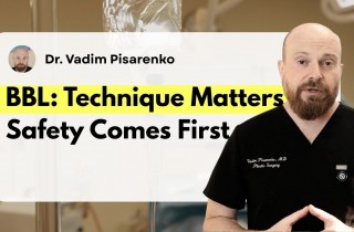 Upper Blepharoplasty While Awake! - 2