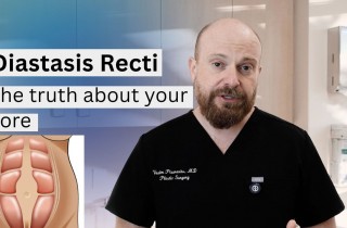 Upper Blepharoplasty While Awake! - 22