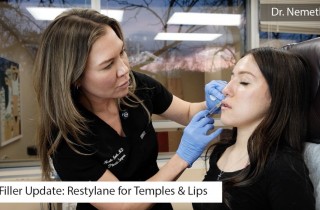 Upper Blepharoplasty While Awake! - 23