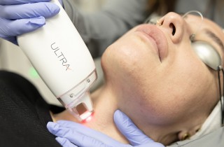 laseMD-3rd-treatment